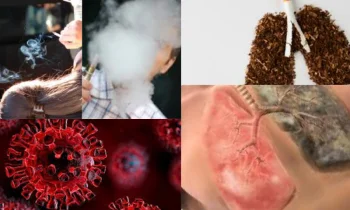Sigaranın Neden Olduğu Başlıca Hastalıklar