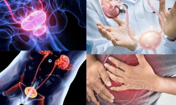 Mesane Kanseri Tedavisi Var Mıdır?