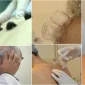 Tıbbi Hacamat İle Anemi Tedavisi