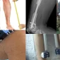 EN ÇOK TERCİH EDİLEN LEG EXTENSION EXERCISES